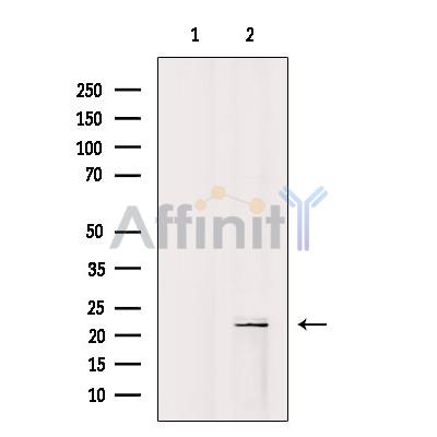 ARL4C Antibody - Western blot analysis of extracts from Colo205, using ARL4C Antibody.
