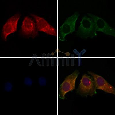 Calumenin Antibody - DF12876 staining Hela cells by IF/ICC.