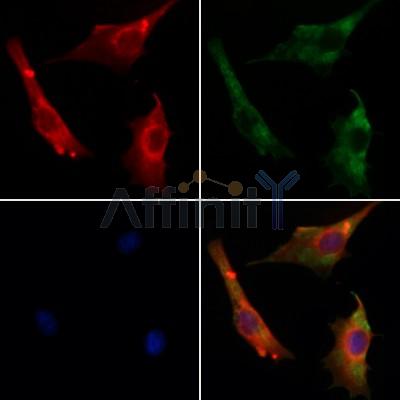 CCNI2 Antibody - DF12887 staining Hela cells by IF/ICC.