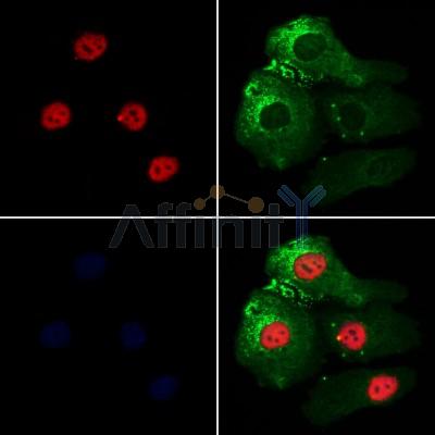 CIP29 Antibody - DF12899 staining Hela cells by IF/ICC.