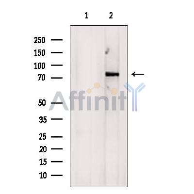 Collagen Type XXIII Antibody - Western blot analysis of extracts from A2780 cells, using Collagen Type XXIII Antibody.