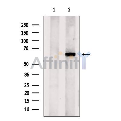 CPNE6 Antibody - Western blot analysis of extracts from 293t, using CPNE6 Antibody.