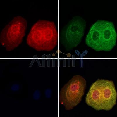 DNAJA2 Antibody - DF12947 staining Hela cells by IF/ICC.