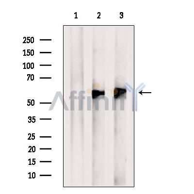 ESRRG Antibody - Western blot analysis of extracts from various samples, using ESRRG Antibody.