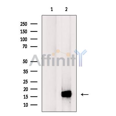 LPPL Antibody - Western blot analysis of extracts from Rat  brain, using LPPL Antibody.