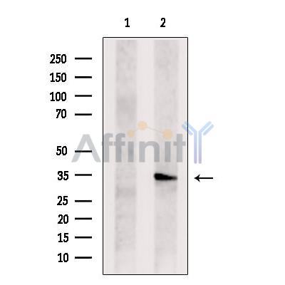 TSSC4 Antibody - Western blot analysis of extracts from B16F10 cells, using TSSC4 Antibody.