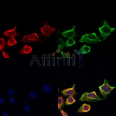 LTK Antibody - DF3146 staining Hela cells by IF/ICC.
