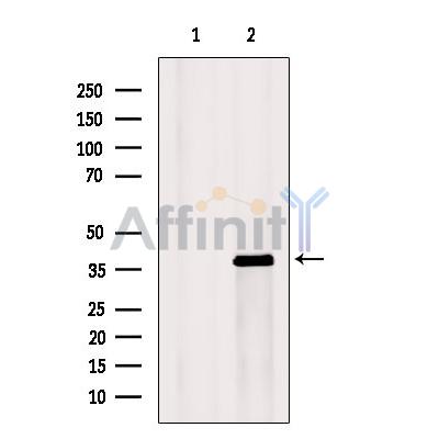 KCNK1 Antibody - Western blot analysis of extracts from Mouse  brain, using KCNK1 Antibody.