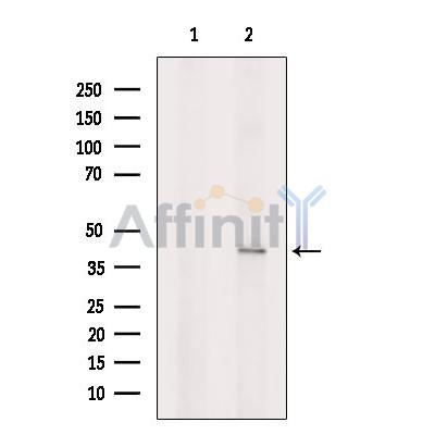 SLC10A7 Antibody - Western blot analysis of extracts from Hela cells, using SLC10A7 Antibody.