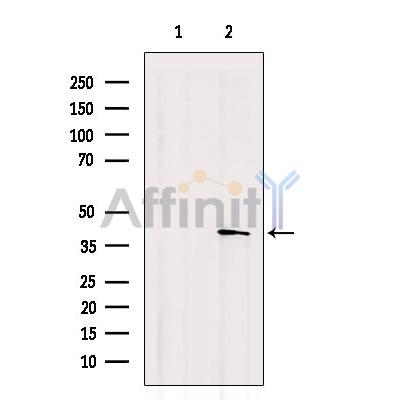 GPR87/GPR95 Antibody - Western blot analysis of extracts from Mouse  kidney, using GPR87 Antibody.