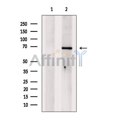 TGFBI Antibody - Western blot analysis of extracts from MCF7, using TGFBI  Antibody.