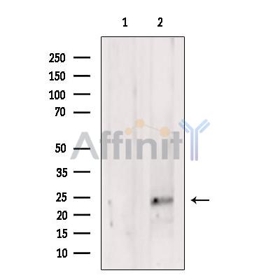NEUROG3 Antibody - Western blot analysis of extracts from Hela cells, using NEUROG3 Antibody.