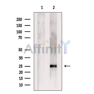 CEND1 Antibody - Western blot analysis of extracts from Mouse  spleen, using CEND1 Antibody.