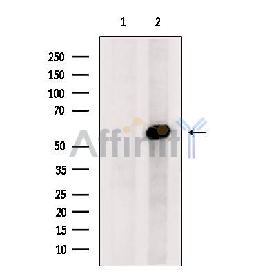 FTO Antibody - Western blot analysis of extracts from Colo205, using FTO Antibody.