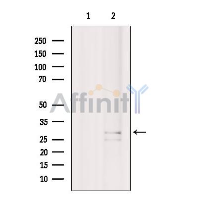 CD320 Antibody - Western blot analysis of extracts from C6 cells, using CD320 Antibody.