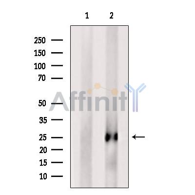 FGF11 Antibody - Western blot analysis of extracts from P19 cells, using FGF11 Antibody.