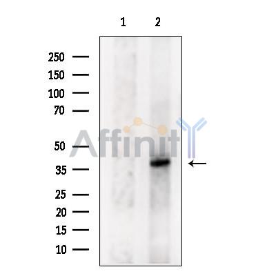 MARCH9 Antibody - Western blot analysis of extracts from MCF7, using MARCH9 Antibody.