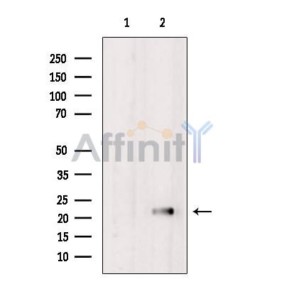 NCALD Antibody - Western blot analysis of extracts from Rat  brain, using NCALD Antibody.