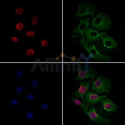 ERK1/2 Antibody - AF0155 staining Hela cells by IF/ICC.