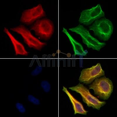 Phospho-FOXO1A (Ser319) Antibody - AF3418 staining Hela cells by IF/ICC.