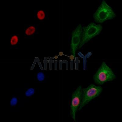 Ring1A Antibody - AF4074 staining Hela cells by IF/ICC.
