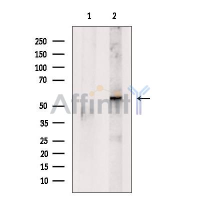 ACV1B Antibody - Western blot analysis of extracts from Colo205, using ACV1B Antibody.