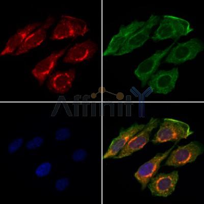 Collagen I Antibody - AF7001 staining Hela cells by IF/ICC.