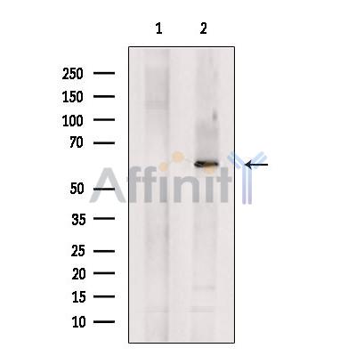 SLC22A8 Antibody - Western blot analysis of extracts from Hela cells, using SLC22A8 Antibody.