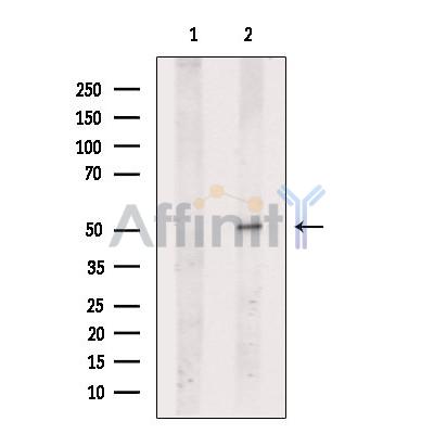 Lck Antibody - Western blot analysis of extracts from B16F10 cells, using Lck Antibody.