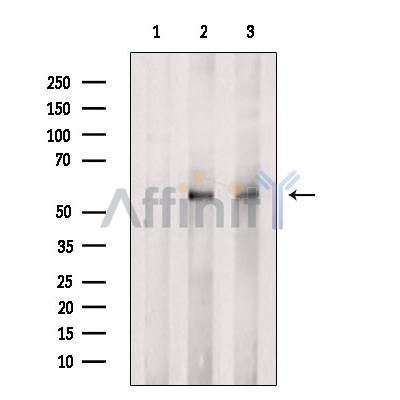 PKM2 Antibody - Western blot analysis of extracts from various samples, using PKM2 Antibody.