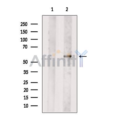 PKM2 Antibody - Western blot analysis of extracts from Hela cells, using PKM2 Antibody.