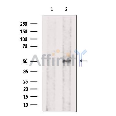 Phospho-ILK (Ser343) Antibody - Western blot analysis of extracts from Mouse  heart, using Phospho-ILK-1 (Ser343) Antibody.