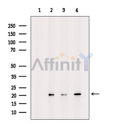 UBE2G1 Antibody - Western blot analysis of extracts from various samples, using UBE2G1 Antibody.