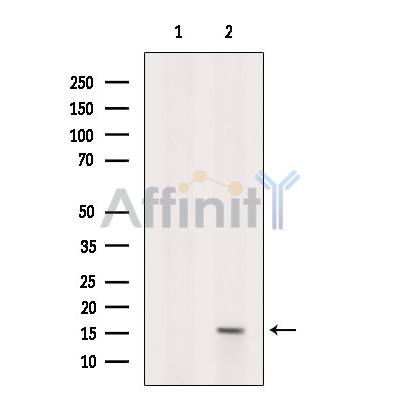 KIAA0087 Antibody - Western blot analysis of extracts from Rat  heart, using KIAA0087 Antibody.