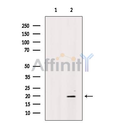 CD164L2 Antibody - Western blot analysis of extracts from Rat  liver, using CD164L2 Antibody.