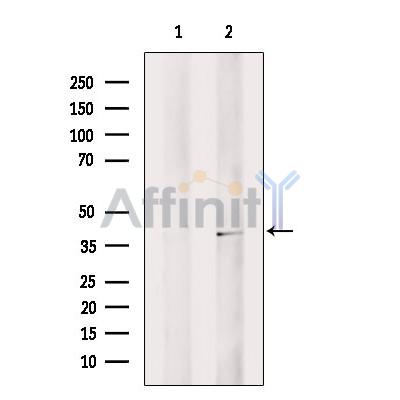 MAGB3 Antibody - Western blot analysis of extracts from MCF7, using MAGB3 Antibody.
