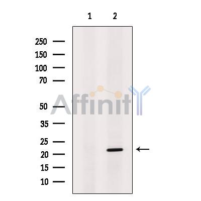 DUX5 Antibody - Western blot analysis of extracts from EC304, using DUX5 Antibody.