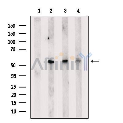 EMID2 Antibody - Western blot analysis of extracts from various samples, using EMID2 Antibody.