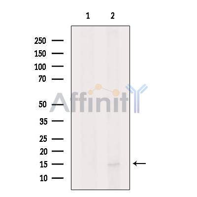 CXCL17 Antibody - Western blot analysis of extracts from MCF7, using CXCL17 Antibody.