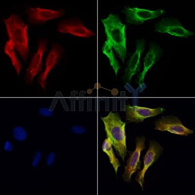 SCGN Antibody - DF10192 staining Hela cells by IF/ICC.