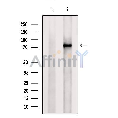 PADI2 Antibody - Western blot analysis of extracts from Rat  lung, using PADI2 Antibody.