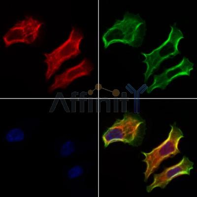 Piezo1 Antibody - DF12083 staining Hela cells by IF/ICC.