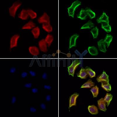SULT4A1 Antibody - DF12088 staining Hela cells by IF/ICC.
