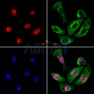 BRD7 Antibody - DF12094 staining Hela cells by IF/ICC.