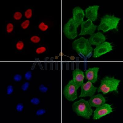DEK Antibody - DF12097 staining Hela cells by IF/ICC.