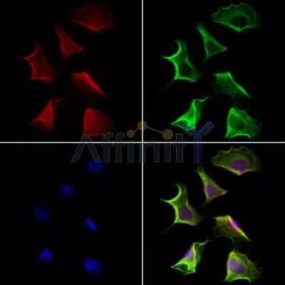 Quiescin Q6 Antibody - DF12104 staining Hela cells by IF/ICC.