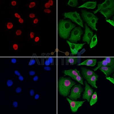 MTA3 Antibody - DF12121 staining Hela cells by IF/ICC.