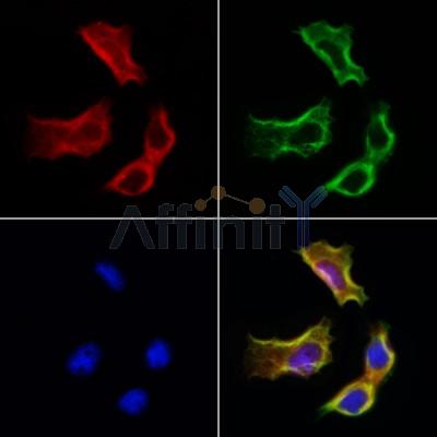 Estrogen Sulfotransferase Antibody - DF12137 staining Hela cells by IF/ICC.