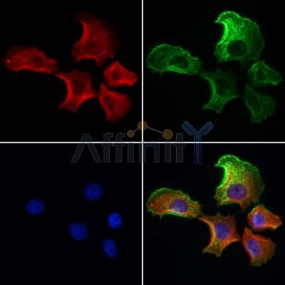 ADRM1 Antibody - DF12142 staining Hela cells by IF/ICC.