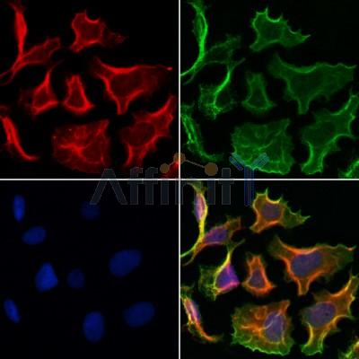 CHMP2A Antibody - DF12147 staining Hela cells by IF/ICC.